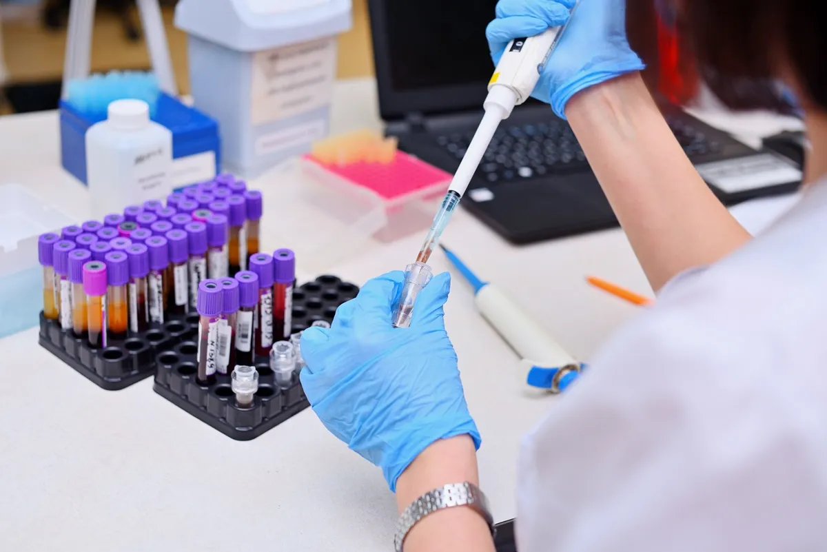 女性の腕から採血する様子